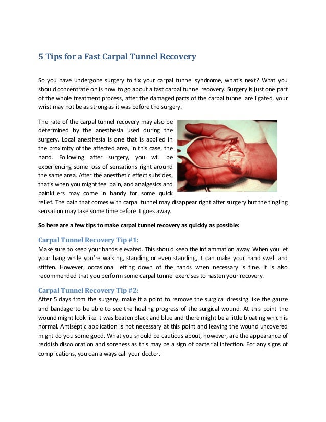 5 Tips for a Fast Carpal Tunnel Recovery