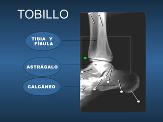 TOBILLO TIBIA  Y  FÍBULA ASTRÁGALO CALCÁNEO 