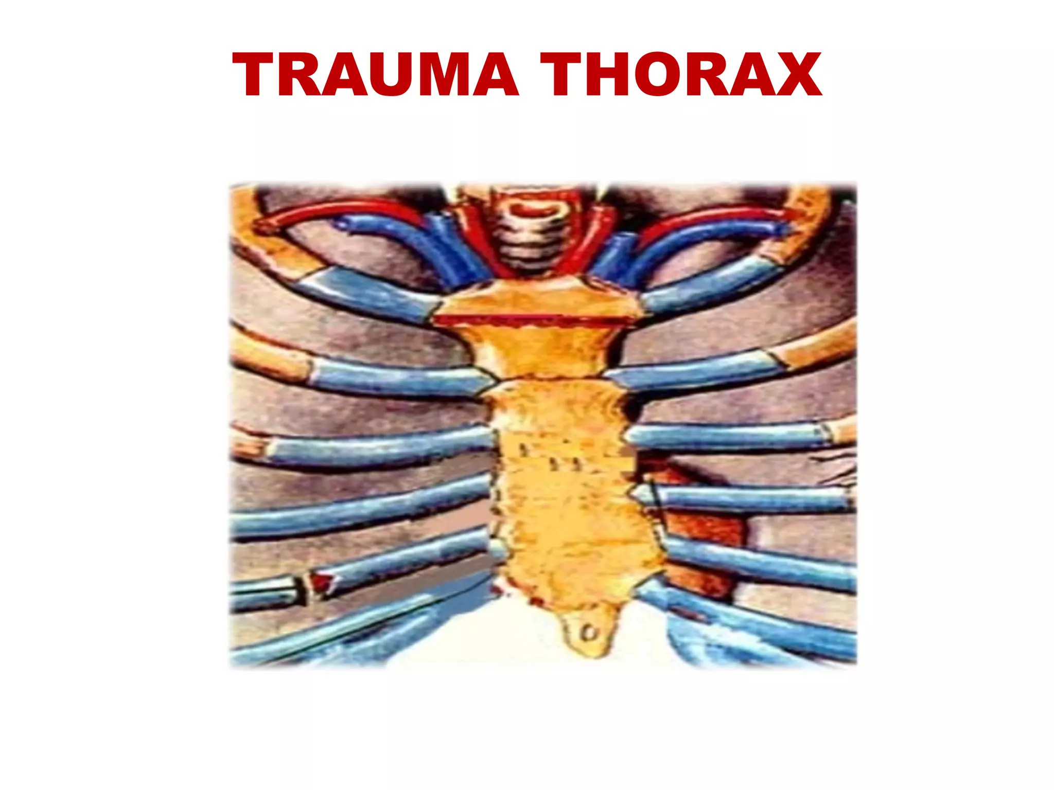 5 Trauma Thorak PDF 5-trauma-thorak-pdf
