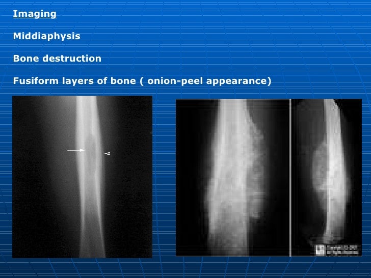 Orthopedics 5th year, 7th/part two & 8th/part one lectures (Dr. Bakht…