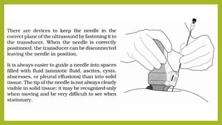 5 ultrasound guided needle biopsy | PPTX