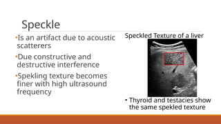 Testacies 5 Ultrasound Artifacts in medical imaging1.pptx