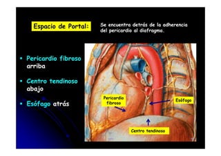 Espacio de Portal: Se encuentra detrás de la adherencia
del pericardio al diafragma.
Pericardio fibroso
arriba
Centro tendinoso
Centro tendinoso
abajo
Esófago atrás
Pericardio
fibroso
Centro tendinoso
Esófago
CFC 14
 