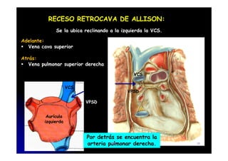 RECESO RETROCAVA DE ALLISON:
Se la ubica reclinando a la izquierda la VCS.
Adelante:
Vena cava superior
Atrás:
Vena pulmonar superior derecha
VCS
VPSD
VCS
VPSD
Aurícula
izquierda
Por detrás se encuentra la
arteria pulmonar derecha.
CFC 31
 