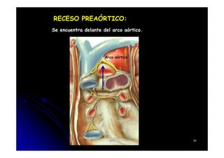 RECESO PREAÓRTICO:
Se encuentra delante del arco aórtico.
Arco aórtico
CFC 33
 