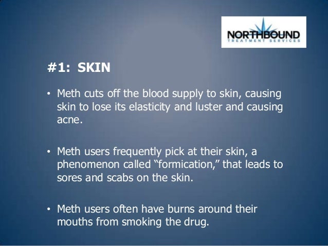 5 Ways Meth Destroys the Body and Mind