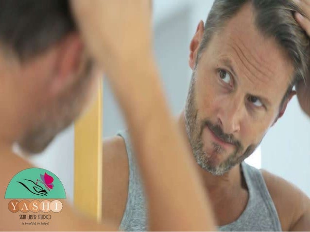 5 Ways To Stop Hair Loss Naturally