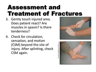 5 wfa bone and joint injuries | PPTX