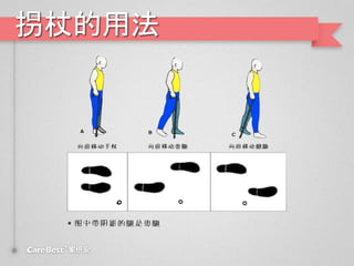 拐杖的用法
 