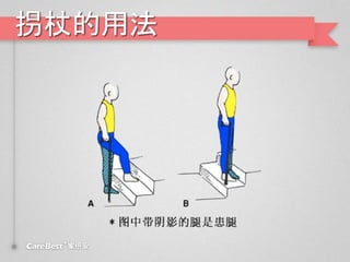 拐杖的用法
 