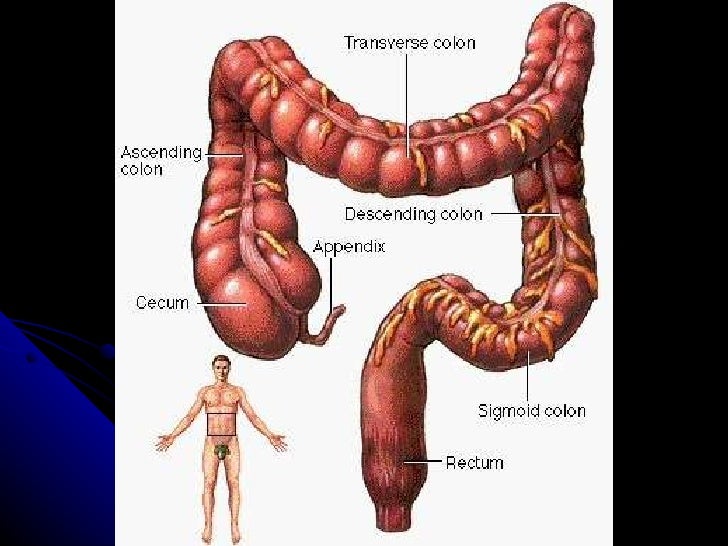 Colon irritable o enfermedad de crohn