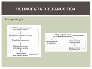 Fisiopatología
RETINOPATÍA DREPANOCITICA
 