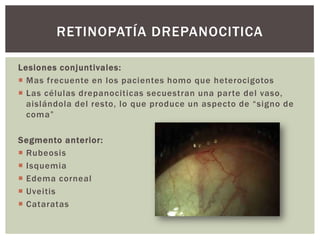 Lesiones conjuntivales:
 Mas frecuente en los pacientes homo que heterocigotos
 Las células drepanociticas secuestran una parte del vaso,
aislándola del resto, lo que produce un aspecto de “signo de
coma”
Segmento anterior:
 Rubeosis
 Isquemia
 Edema corneal
 Uveitis
 Cataratas
RETINOPATÍA DREPANOCITICA
 