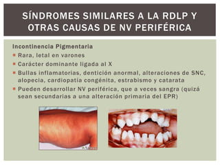 Incontinencia Pigmentaria
 Rara, letal en varones
 Carácter dominante ligada al X
 Bullas inflamatorias, dentición anormal, alteraciones de SNC,
alopecia, cardiopatía congénita, estrabismo y catarata
 Pueden desarrollar NV periférica, que a veces sangra (quizá
sean secundarias a una alteración primaria del EPR)
SÍNDROMES SIMILARES A LA RDLP Y
OTRAS CAUSAS DE NV PERIFÉRICA
 