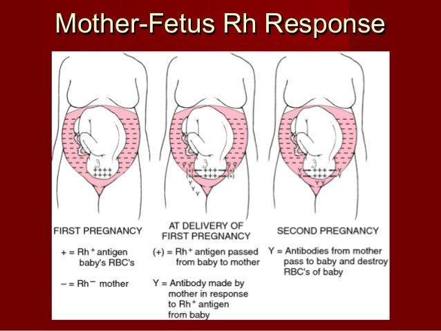 Modern Rhesus Typing In Transfusion And Pregnancy – GZVZU
