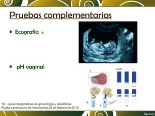 Pruebas complementarias
• Ecografía

8

• pH vaginal

10.- Guías diagnósticas de ginecología y obstetricia.
Ruptura prematura de membranas:25 de febrero de 2010.

 