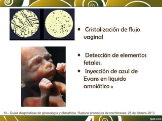 • Cristalización de flujo
vaginal
• Detección de elementos
fetales.
• Inyección de azul de
Evans en liquido
amniótico 8

10.- Guías diagnósticas de ginecología y obstetricia. Ruptura prematura de membranas: 25 de febrero 2010.

 