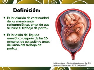 Definición:
• Es la solución de continuidad
de las membranas
corioamnióticas antes de que
se inicie el trabajo de parto.1
• Es la salida del líquido
amniótico después de las 20
semanas de gestación y antes
del inicio del trabajo de
parto.2

1.- Ginecología y Obstetricia Aplicadas. 2a. Ed.
2.- Ginecol Obstet Mex 2008;76(8):468-75

 