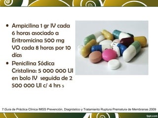 • Ampicilina 1 gr IV cada
6 horas asociado a
Eritromicina 500 mg
VO cada 8 horas por 10
días
• Penicilina Sódica
Cristalina: 5 000 000 UI
en bolo IV seguida de 2
500 000 UI c/ 4 hrs 5

7.Guía de Práctica Clínica IMSS Prevención, Diagnóstico y Tratamiento Ruptura Prematura de Membranas 2009

 