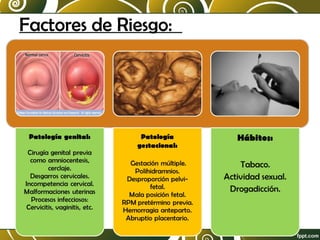 Factores de Riesgo:

 
