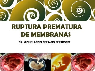 RUPTURA PREMATURA
DE MEMBRANAS
DR. MIGUEL ANGEL SERRANO BERRRONES

 