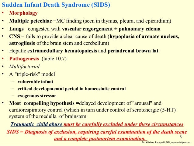sudden infant death syndrome essay We will write a custom essay sample on obesity, asthma, type 1 and type 2 diabetes, sudden infant death syndrome benefits of breastfeeding. sudden infant death syndrome essay We will write a custom essay sample on obesity, asthma, type 1 and type 2 diabetes, sudden infant death syndrome benefits of breastfeeding.