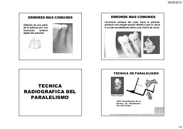 Bisectriz