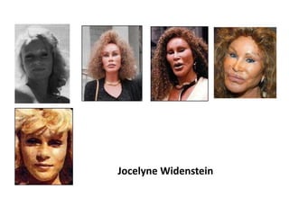Jocelyne Widenstein

 
