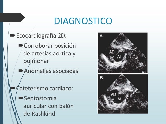 TRANSPOSICION DE GRANDES VASOS PRESENTACION