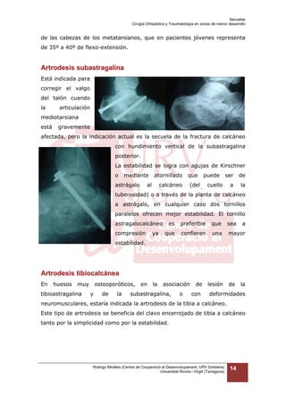 Secuelas
Cirugía Ortopédica y Traumatología en zonas de menor desarrollo

de las cabezas de los metatarsianos, que en pacientes jóvenes representa
de 35º a 40º de flexo-extensión.

Artrodesis subastragalina
Está indicada para
corregir el valgo
del talón cuando
la

articulación

mediotarsiana
está

gravemente

afectada, pero la indicación actual es la secuela de la fractura de calcáneo
con hundimiento vertical de la subastragalina
posterior.
La estabilidad se logra con agujas de Kirschner
o

mediante

astrágalo

atornillado

al

calcáneo

que

puede

(del

ser

de

a

la

cuello

tuberosidad) o a través de la planta de calcáneo
a astrágalo, en cualquier caso dos tornillos
paralelos ofrecen mejor estabilidad. El tornillo
astragalocalcáneo
compresión

ya

es

preferible

que

sea

a

que

confieren

una

mayor

estabilidad.

Artrodesis tibiocalcánea
En

huesos

muy

tibioastragalina

osteoporóticos,
y

de

la

en

la

asociación

subastragalina,

o

de
con

lesión

de

la

deformidades

neuromusculares, estaría indicada la artrodesis de la tibia a calcáneo.
Este tipo de artrodesis se beneficia del clavo encerrojado de tibia a calcáneo
tanto por la simplicidad como por la estabilidad.

Rodrigo Miralles (Centre de Cooperació al Desenvolupament, URV Solidaria)
Universitat Rovira i Virgili (Tarragona)

14

 