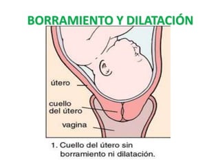 BORRAMIENTO Y DILATACIÓN
 