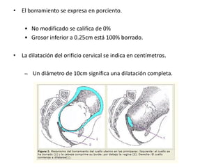 • El borramiento se expresa en porciento.
• No modificado se califica de 0%
• Grosor inferior a 0.25cm está 100% borrado.
• La dilatación del orificio cervical se indica en centímetros.
– Un diámetro de 10cm significa una dilatación completa.
 