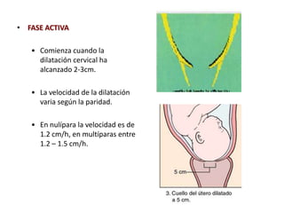 • FASE ACTIVA
• Comienza cuando la
dilatación cervical ha
alcanzado 2-3cm.
• La velocidad de la dilatación
varia según la paridad.
• En nulípara la velocidad es de
1.2 cm/h, en multíparas entre
1.2 – 1.5 cm/h.
 