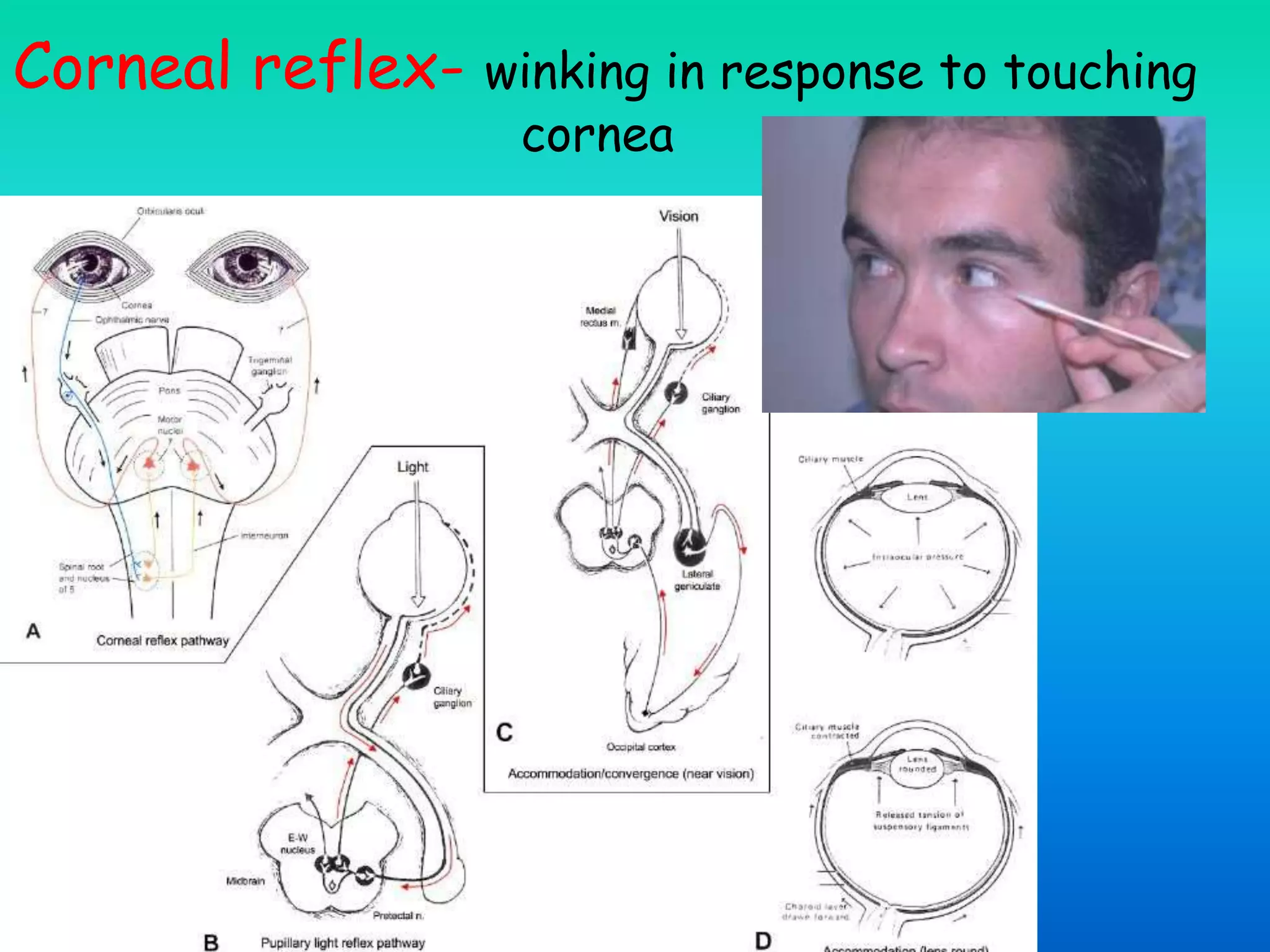 Corneal reflex- winking in response to touching
cornea
 
