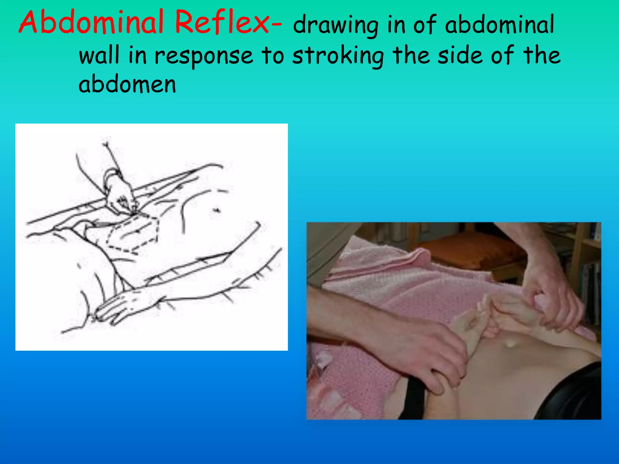 Abdominal Reflex- drawing in of abdominal
wall in response to stroking the side of the
abdomen
 