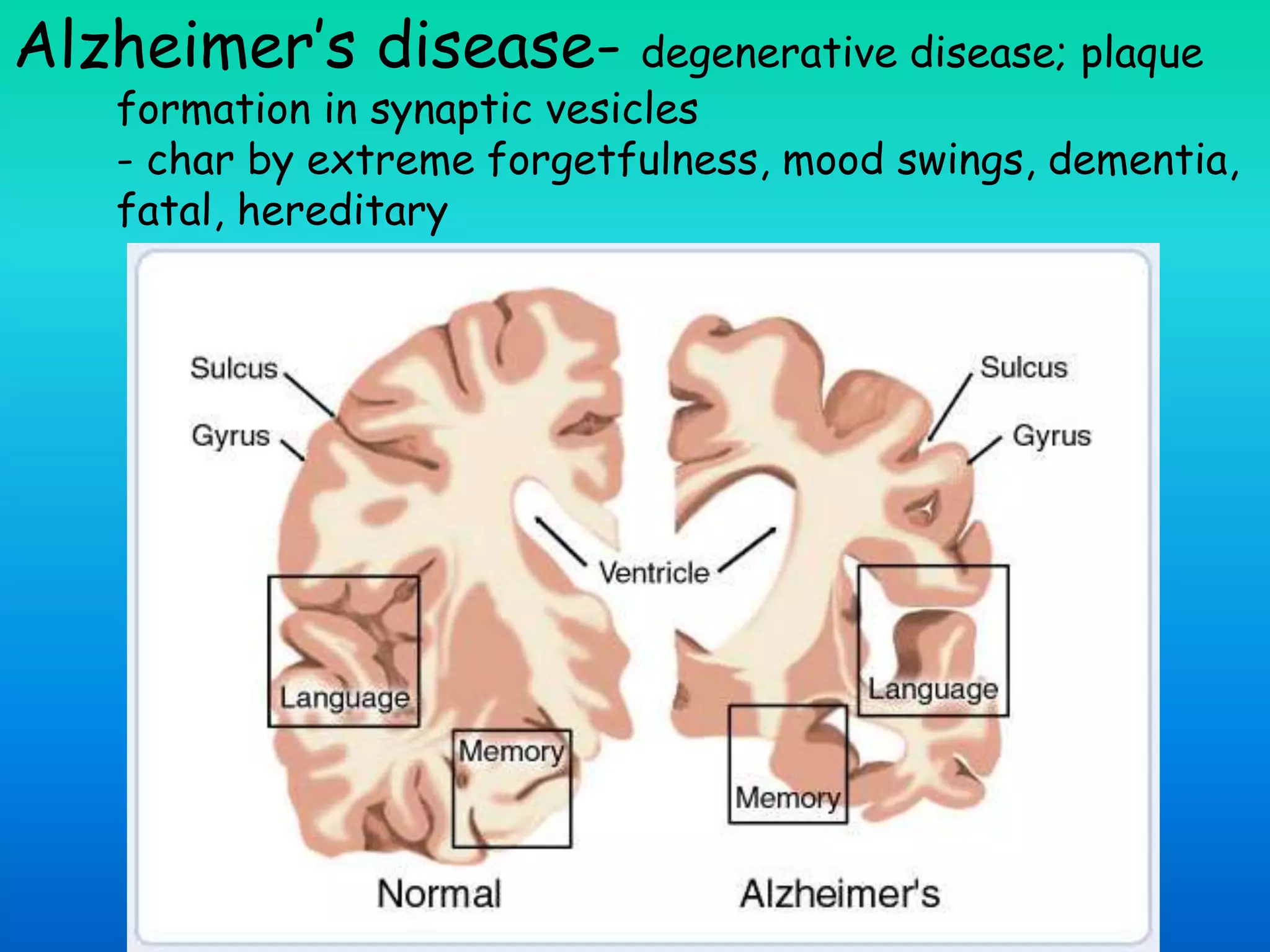 Alzheimer’s disease- degenerative disease; plaque
formation in synaptic vesicles
- char by extreme forgetfulness, mood swings, dementia,
fatal, hereditary
 