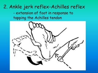 2. Ankle jerk reflex-Achilles reflex
- extension of foot in response to
tapping the Achilles tendon
 