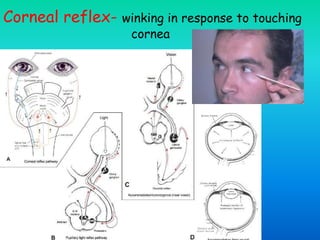 Corneal reflex- winking in response to touching
cornea
 