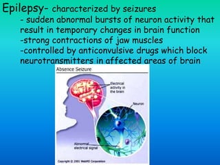 Epilepsy- characterized by seizures
- sudden abnormal bursts of neuron activity that
result in temporary changes in brain function
-strong contractions of jaw muscles
-controlled by anticonvulsive drugs which block
neurotransmitters in affected areas of brain
 