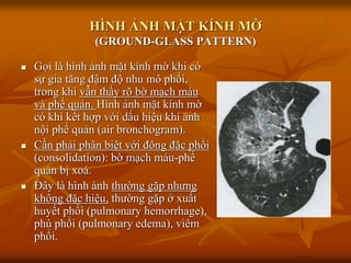 HÌNH ẢNH MẶT KÍNH MỜ
(GROUND-GLASS PATTERN)
 Gọi là hình ảnh mặt kính mờ khi có
sự gia tăng đậm độ nhu mô phổi,
trong khi vẫn thấy rõ bờ mạch máu
và phế quản. Hình ảnh mặt kính mờ
có khi kết hợp với dấu hiệu khí ảnh
nội phế quản (air bronchogram).
 Cần phải phân biệt với đông đặc phổi
(consolidation): bờ mạch máu-phế
quản bị xoá.
 Đây là hình ảnh thƣờng gặp nhƣng
không đặc hiệu, thƣờng gặp ở xuất
huyết phổi (pulmonary hemorrhage),
phù phổi (pulmonary edema), viêm
phổi.
 