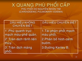 39
X QUANG PHUØ PHOÅI CAÁP
PHUØ PHOÅI DO NGUYEÂN NHAÂN TIM
(CARDIOGENIC PULMONARY EDEMA)
DAÁU HIEÄU KHOÂNG
CHUYEÂN BIEÄT
DAÁU HIEÄU CHUYEÂN BIEÄT
1’.Phuø quanh truïc
maïch maùu-pheá quaûn.
2’.Traøn dòch raõnh lieân
thuøy.
3’.Traøn dòch maøng
phoåi.
1.Taùi phaân phoái maïch
maùu phoåi.
2.Phaân boá hình caùnh
böôùm.
3.Ñöôøng Kerley B.
 