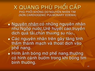 45
X QUANG PHUØ PHOÅI CAÁP
PHUØ PHOÅI KHOÂNG DO NGUYEÂN NHAÂN TIM
(NON CARDIOGENIC PULMONARY EDEMA)
 Nguyeân nhaân:coù nhöõng nguyeân nhaân
nhö:Ngoäp nöôùc,Ureâ huyeát cao,truyeàn
dòch quaù taûi,chấn thƣơng sọ não…
 Caùc nguyeân nhaân treân gaây taêng tính
thaám thaønh maïch vaø thoaùt dòch vaøo
pheá nang.
 Hình aûnh boùng môø pheá nang,thöôøng
coù hình caùnh böôùm trong khi boùng tim
bình thöôøng.
 