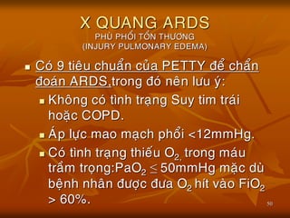 50
X QUANG ARDS
PHUØ PHOÅI TOÅN THÖÔNG
(INJURY PULMONARY EDEMA)
 Coù 9 tieâu chuaån cuûa PETTY ñeå chaån
ñoaùn ARDS,trong ñoù neân löu yù:
 Khoâng coù tình traïng Suy tim traùi
hoaëc COPD.
 AÙp löïc mao maïch phoåi <12mmHg.
 Coù tình traïng thieáu O2, trong maùu
traàm troïng:PaO2 ≤ 50mmHg maëc duø
beänh nhaân ñöôïc ñöa O2 hít vaøo FiO2
> 60%.
 