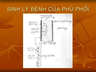 69
SINH LYÙ BEÄNH CUÛA PHUØ PHOÅI
 
