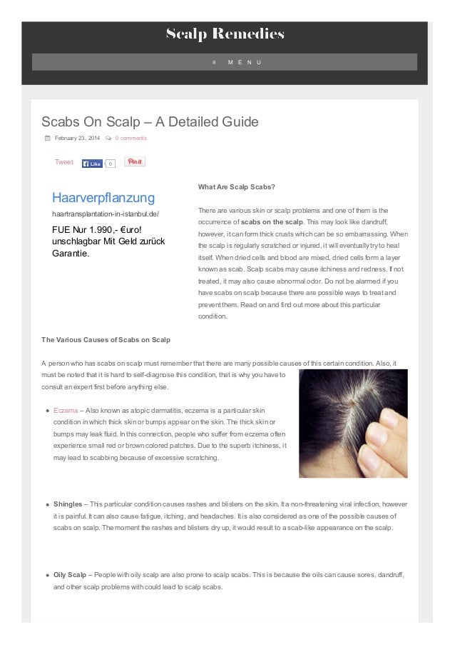 Scabs On Scalp A Detailed Guide