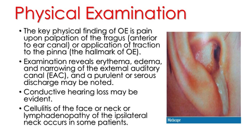 6. otitis externa