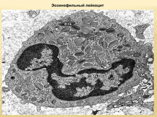 Эозинофильный лейкоцит 
 