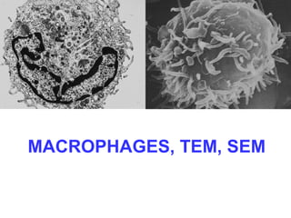 MACROPHAGES, TEM, SEM 
 