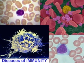 Diseases of IMMUNITY 
 