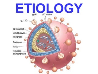 ETIOLOGY 
 